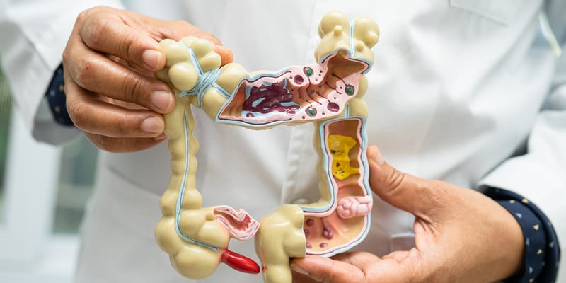 A diagram of the GI tract