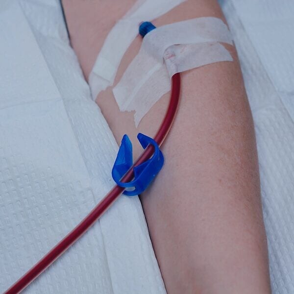 The EBOO blood-filtration procedure