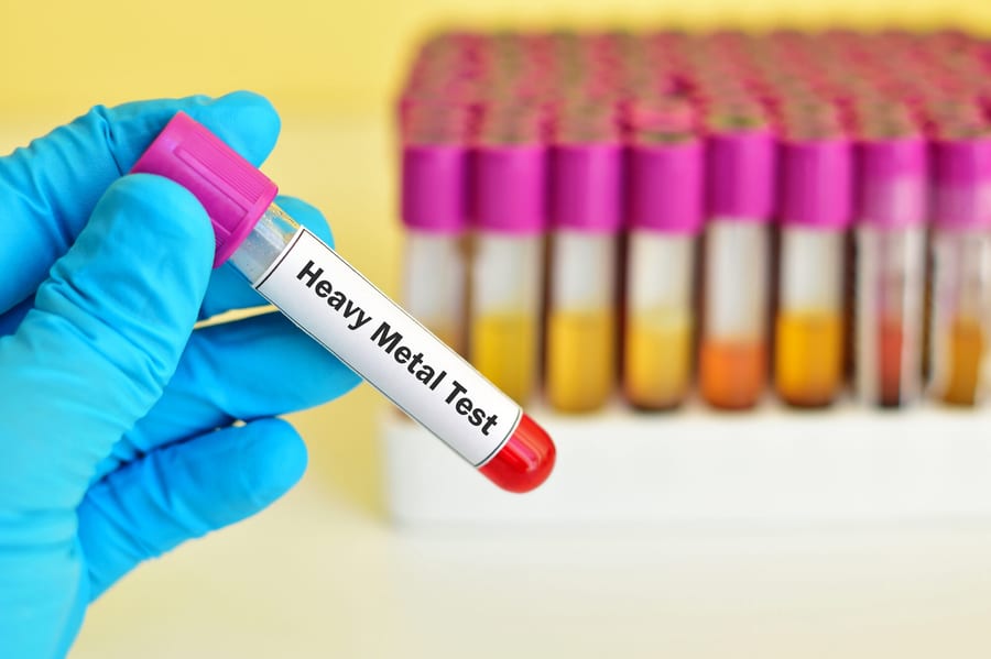 Testing for heavy metals and toxic burden